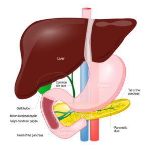 Pancreatitis